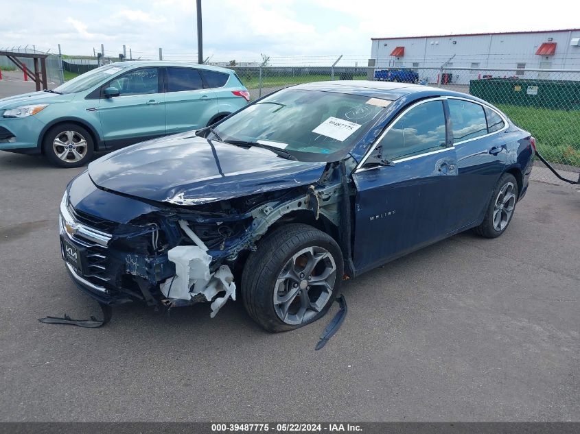 1G1ZD5STXLF140826 2020 CHEVROLET MALIBU - Image 2