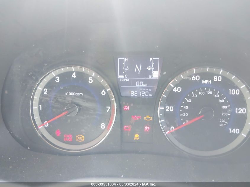 2017 Hyundai Accent Se VIN: KMHCT5AE7HU311517 Lot: 39551034