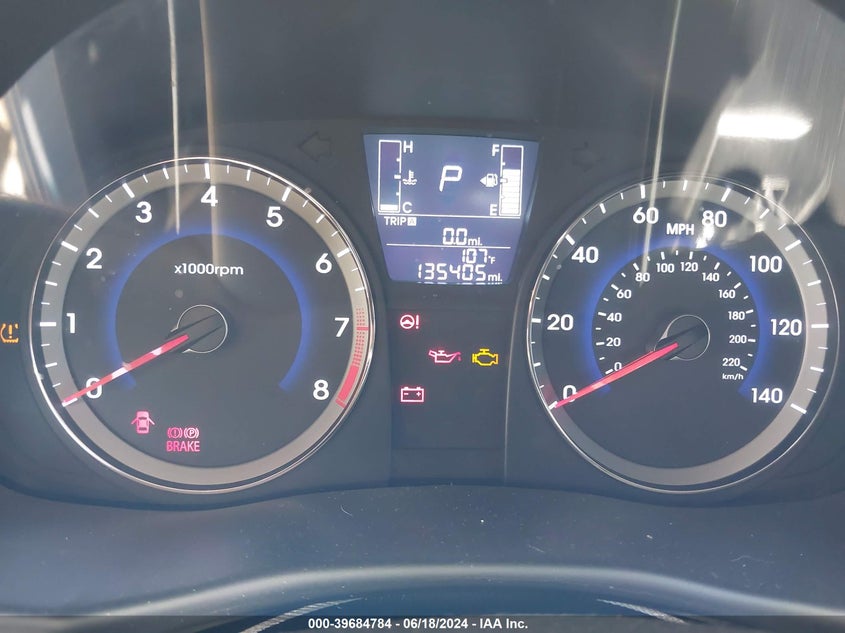 2017 HYUNDAI ACCENT SE - KMHCT5AE3HU335104