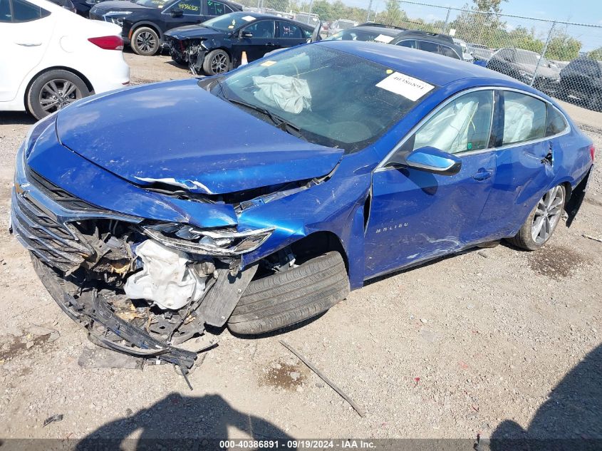 1G1ZE5ST6PF156427 2023 CHEVROLET MALIBU - Image 2