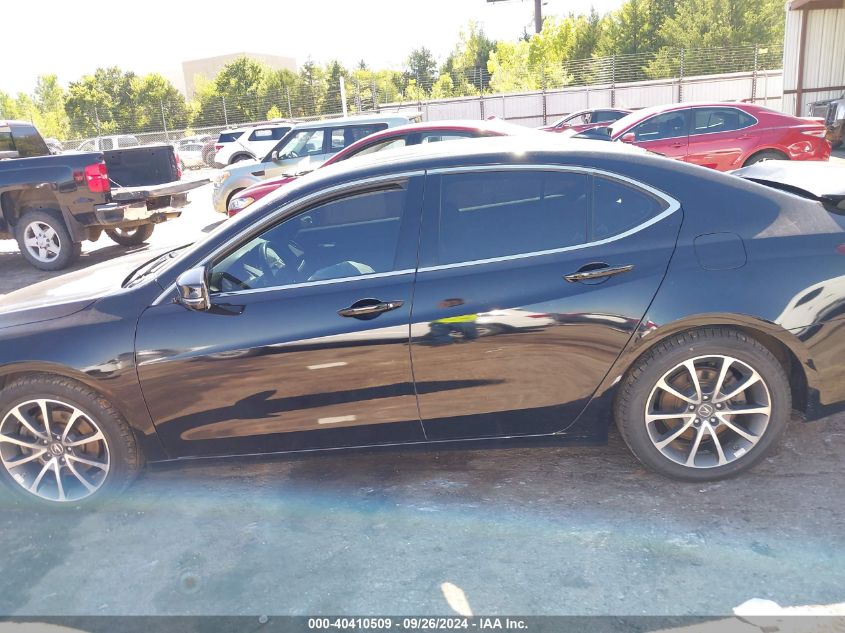 19UUB3F70HA002632 2017 Acura Tlx Advance