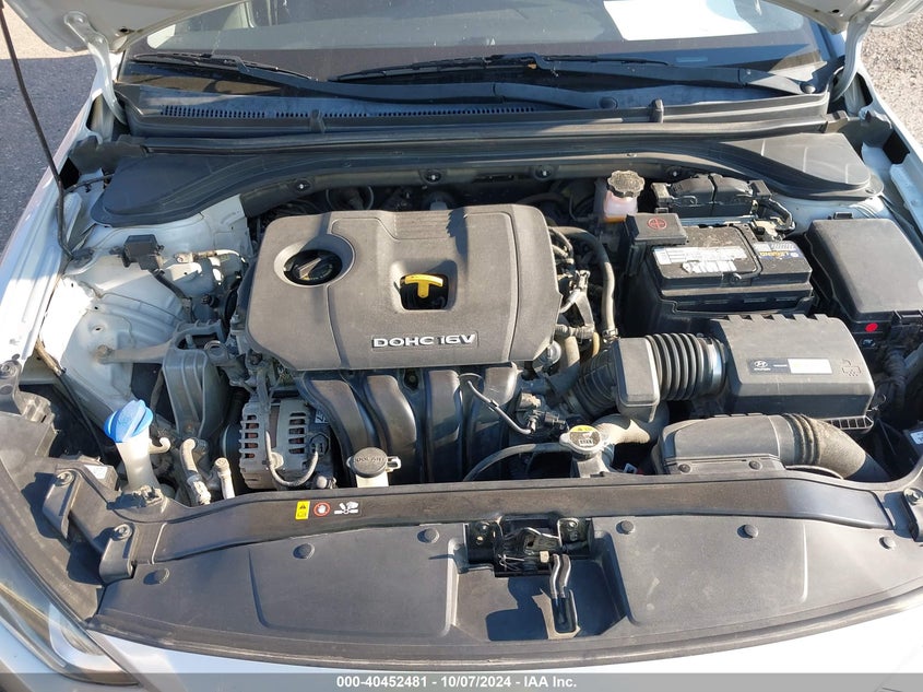 KMHD84LF5HU281519 2017 Hyundai Elantra Limited