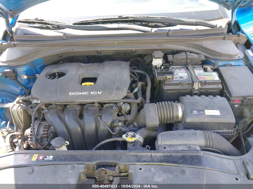 KMHD74LFXHU095655 2017 Hyundai Elantra Se