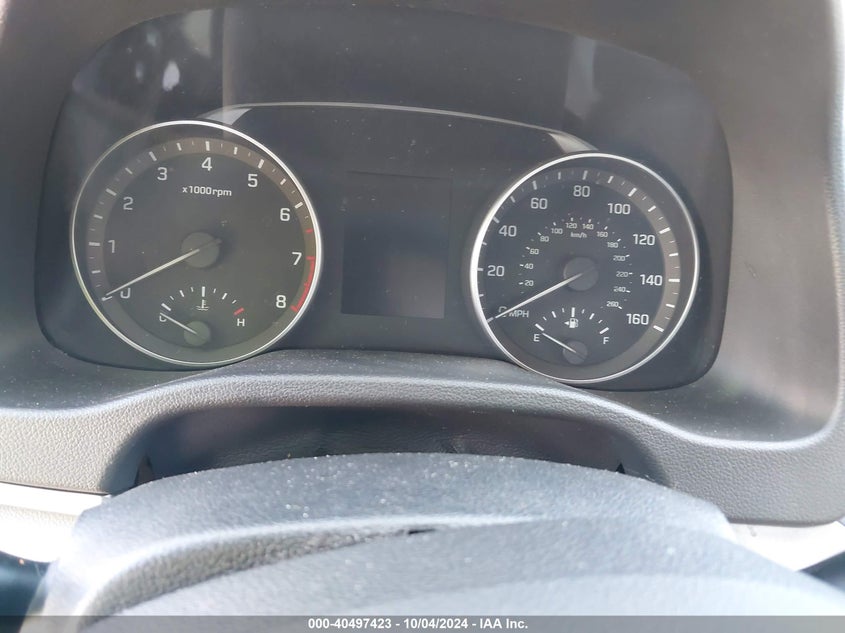 KMHD74LFXHU095655 2017 Hyundai Elantra Se