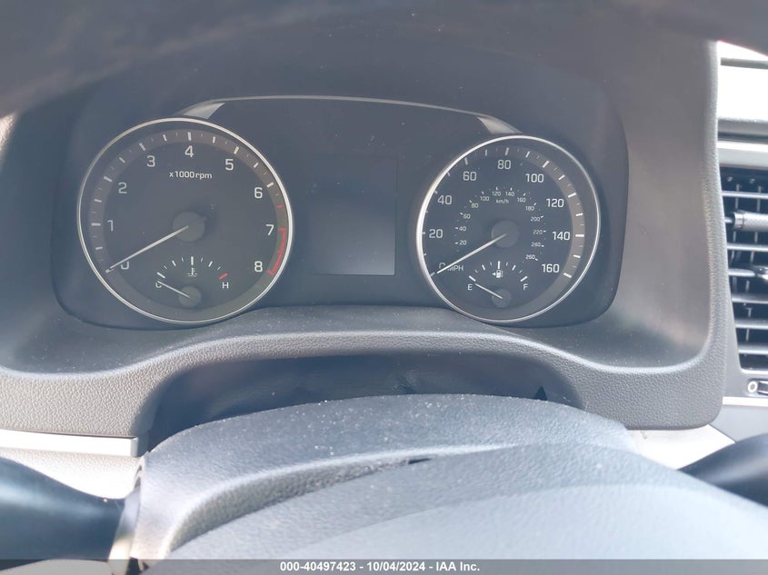 KMHD74LFXHU095655 2017 Hyundai Elantra Se