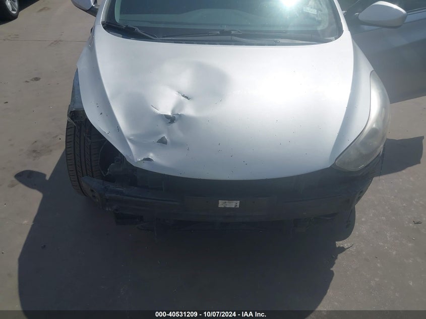 KMHDH4AE1FU300929 2015 Hyundai Elantra Se/Sport/Limited