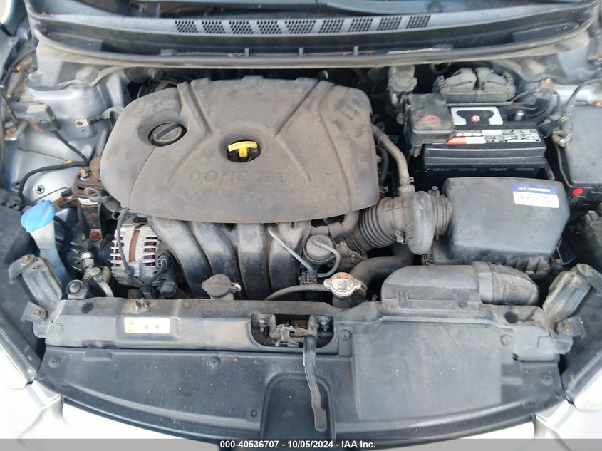 KMHDH4AE1FU413330 2015 Hyundai Elantra Se