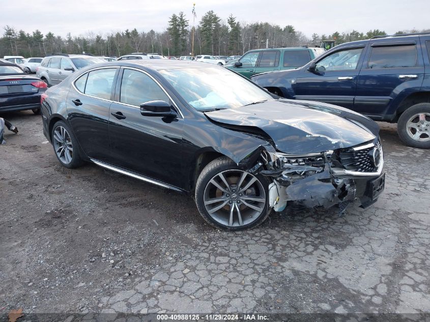 2020 Acura TLX, Tech Package