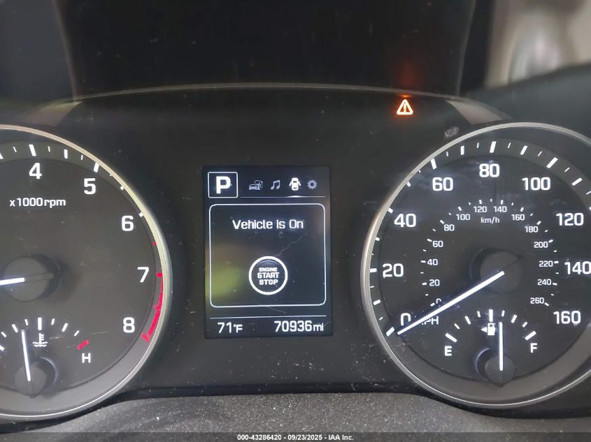 2017 Hyundai Elantra Value Edition VIN: 5NPD84LFXHH186274 Lot: 43286420