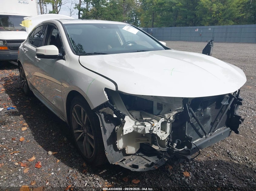 ACURA TLX TECH PACKAGE