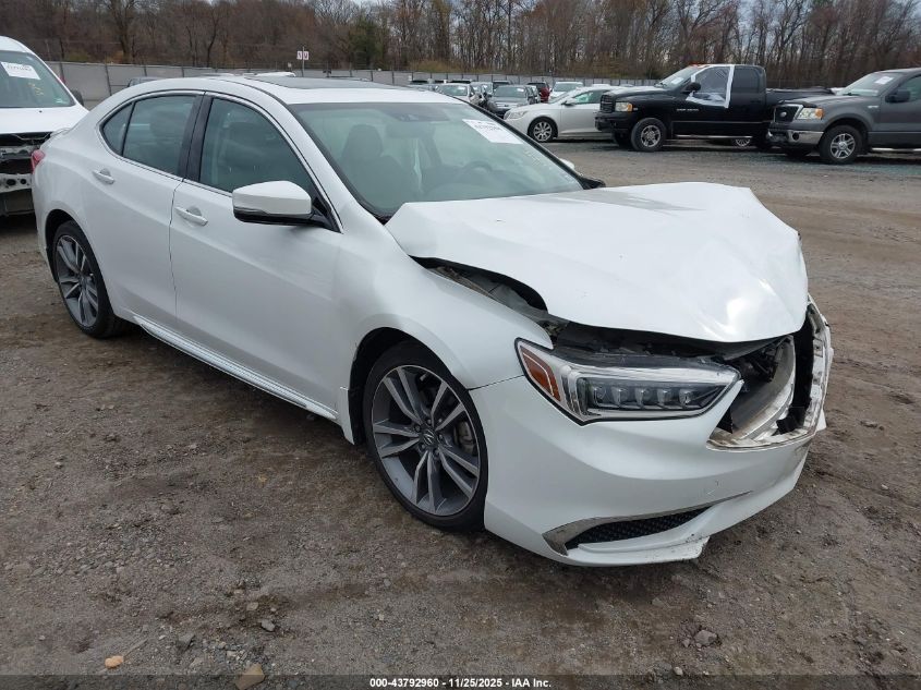 ACURA TLX TECH PACKAGE