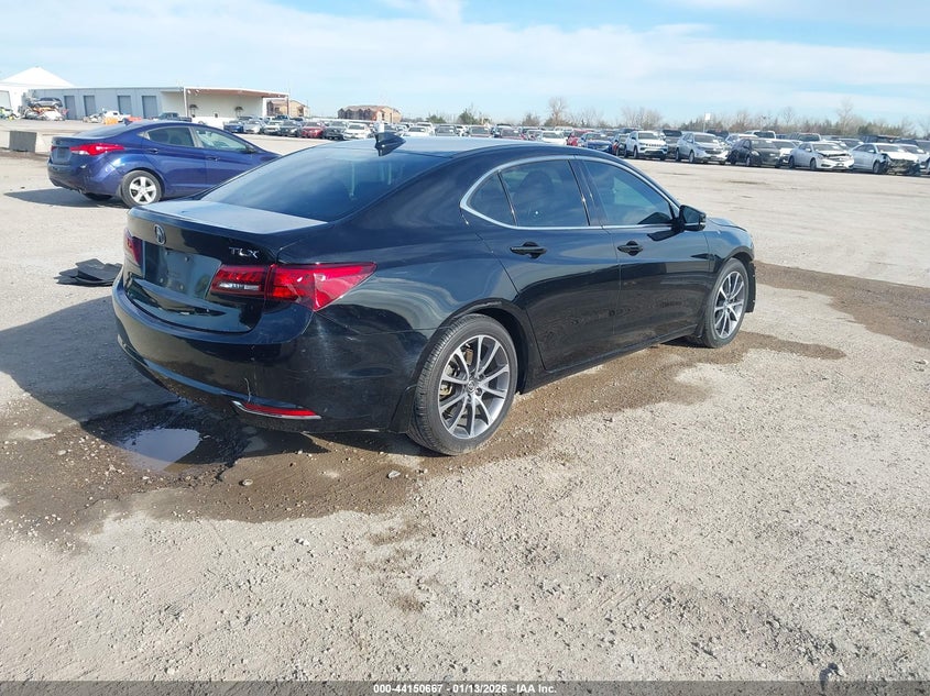 2017 Acura Tlx Technology Package