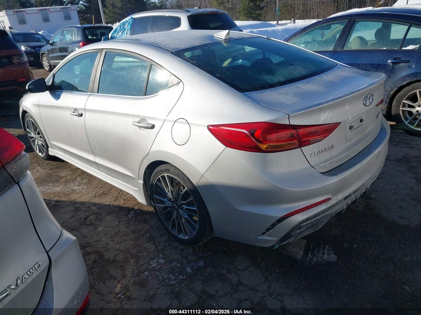 2017 Hyundai Elantra Sport