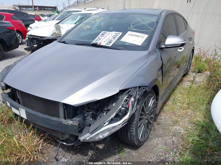 2017 Hyundai Elantra Sport