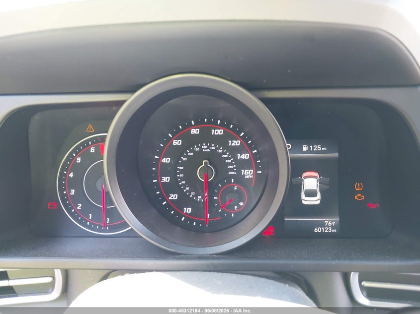 2021 HYUNDAI ELANTRA auction photo 7
