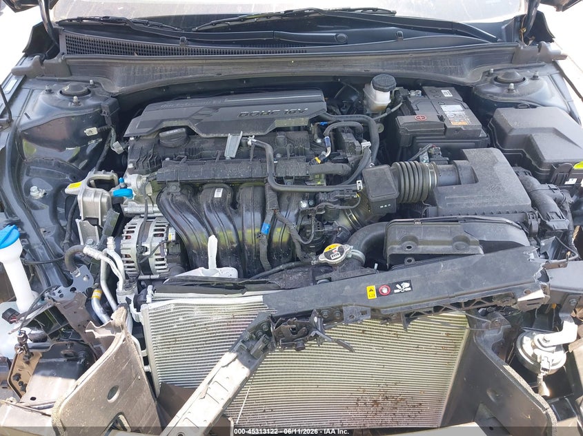 2025 HYUNDAI ELANTRA SEL CONVENIENCE — Photo 10