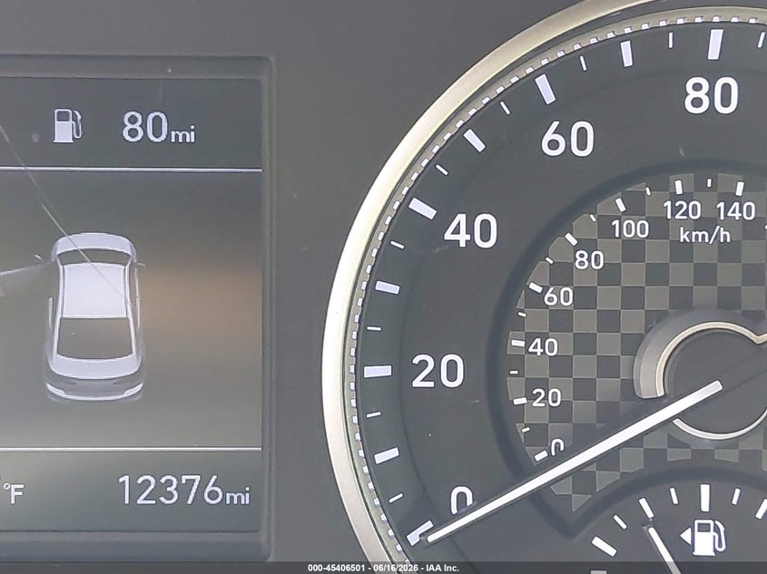 2020 HYUNDAI ELANTRA SE — Photo 15