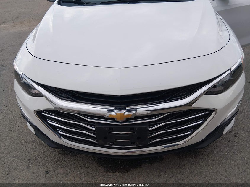 2024 CHEVROLET MALIBU FWD 1FL — Photo 6