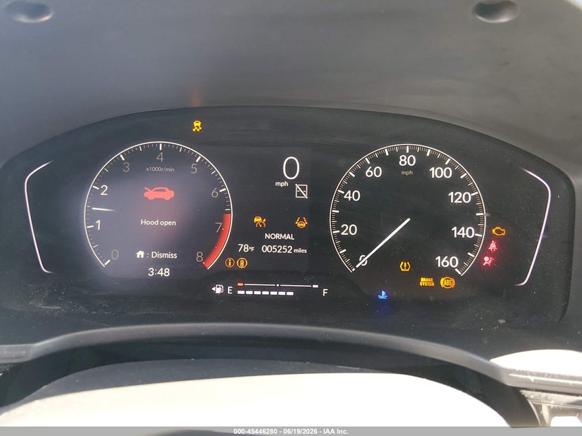 2026 HONDA CIVIC SEDAN 2.0L I-4 DI, DOHC, VVT, 150HP