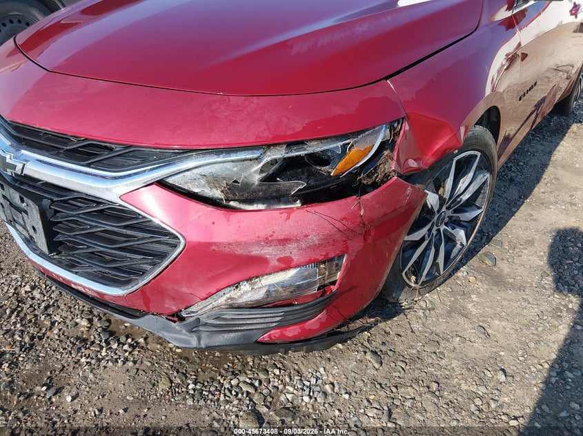 2025 CHEVROLET MALIBU auction photo 6