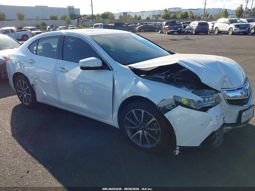 2017 ACURA TLX TECHNOLOGY PACKAGE