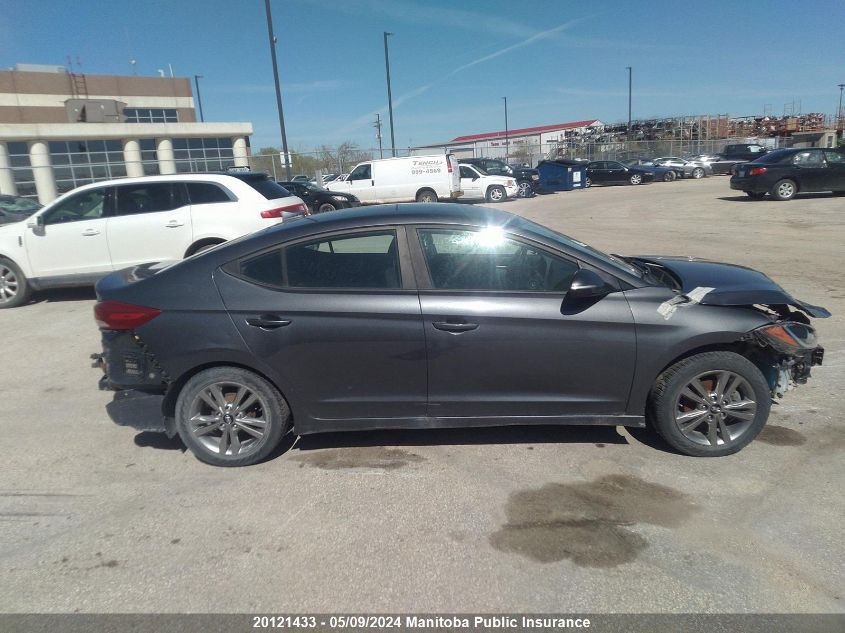 2017 Hyundai Elantra Gls VIN: KMHD84LF9HU101006 Lot: 20121433