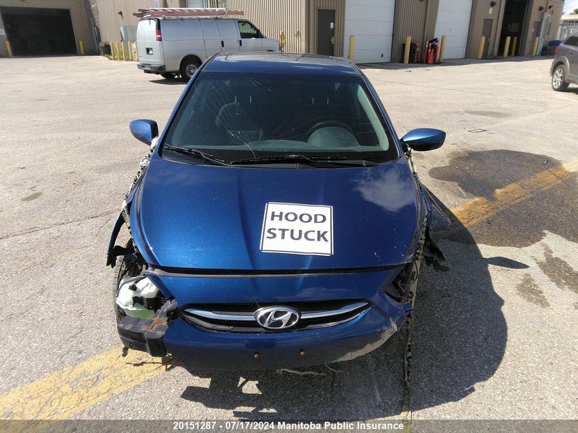 2017 Hyundai Accent L VIN: KMHCT5AE9HU310322 Lot: 20151287