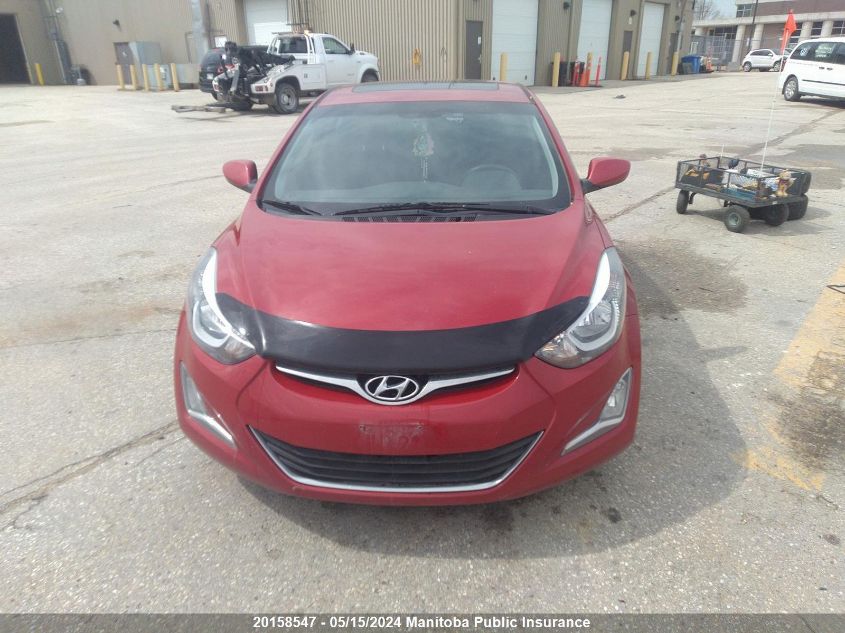 2015 Hyundai Elantra Se VIN: KMHDH4AE1FU285879 Lot: 20158547