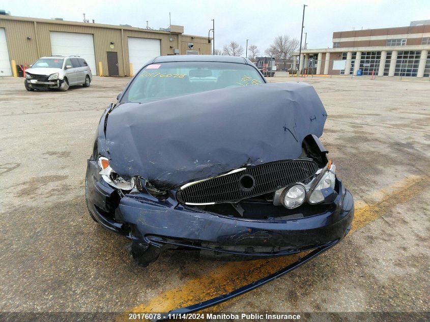 2007 Buick Allure Cx VIN: 2G4WF582371234770 Lot: 20176078