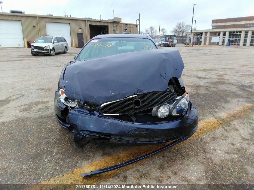 2007 Buick Allure Cx VIN: 2G4WF582371234770 Lot: 20176078