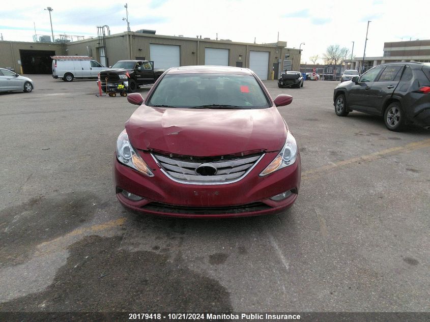 2011 Hyundai Sonata Gls VIN: 5NPEB4AC8BH269899 Lot: 20179418