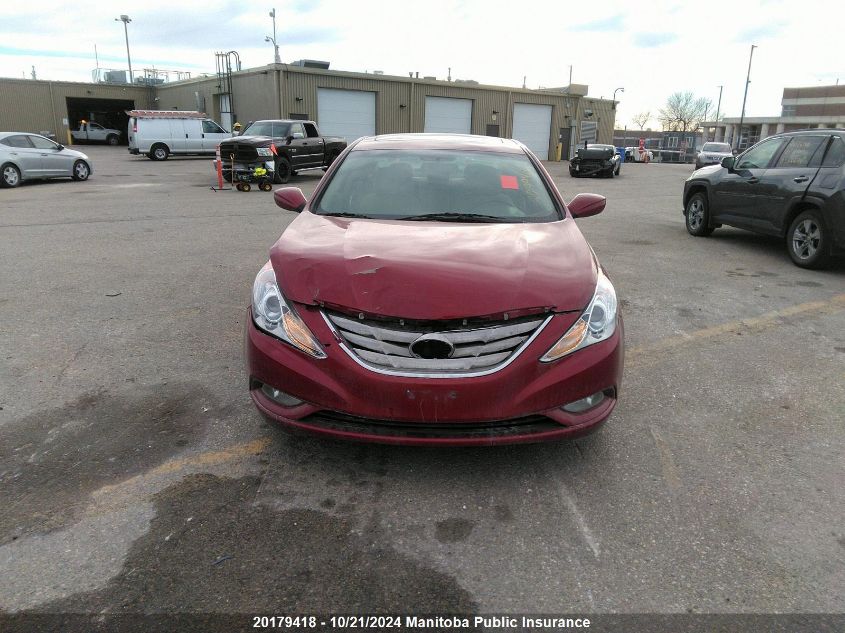 2011 Hyundai Sonata Gls VIN: 5NPEB4AC8BH269899 Lot: 20179418