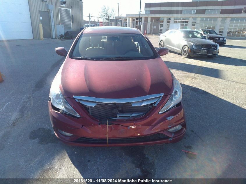 2013 Hyundai Sonata Gls VIN: 5NPEB4AC2DH513159 Lot: 20181520