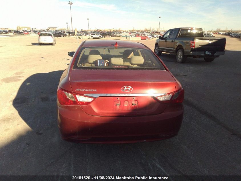 2013 Hyundai Sonata Gls VIN: 5NPEB4AC2DH513159 Lot: 20181520