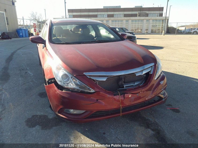 2013 Hyundai Sonata Gls VIN: 5NPEB4AC2DH513159 Lot: 20181520