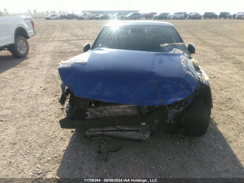 2020 Hyundai Veloster Turbo/Turbo R-Spec/Turbo VIN: KMHTH6AB0LU023764 Lot: 11709284