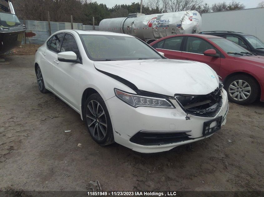 2015 Acura Tlx V6 Tech VIN: 19UUB3F52FA801646 Lot: 11851949