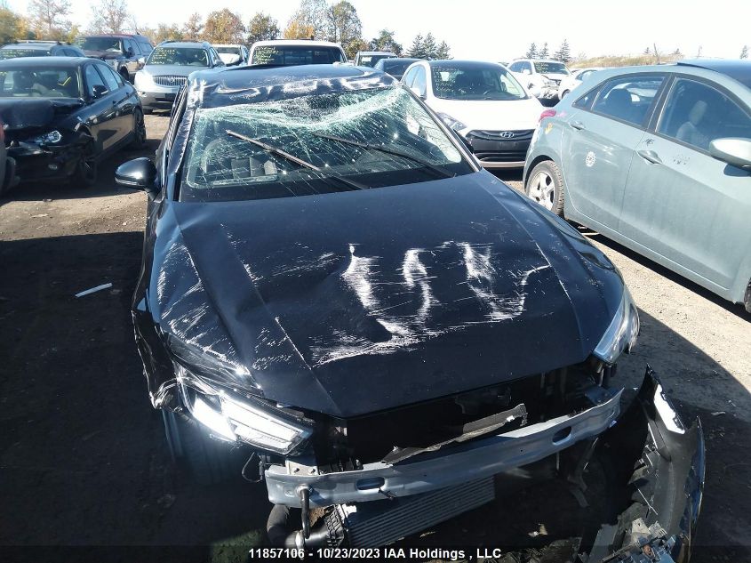 2017 Audi A4 Komfort VIN: WAUANAF42HN039898 Lot: 11857106