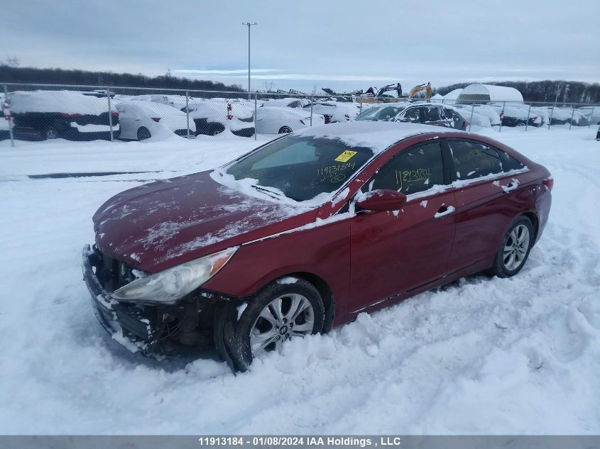 2011 Hyundai Sonata Gl/Gls VIN: 5NPEB4AC8BH089113 Lot: 11913184