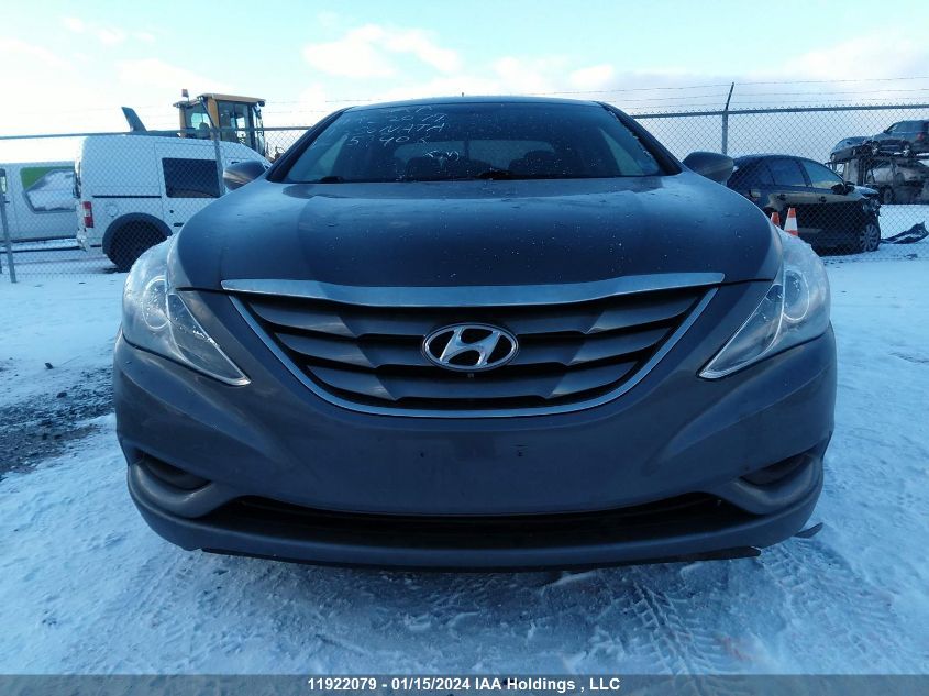 2011 Hyundai Sonata Gls VIN: 5NPEB4AC1BH159406 Lot: 11922079