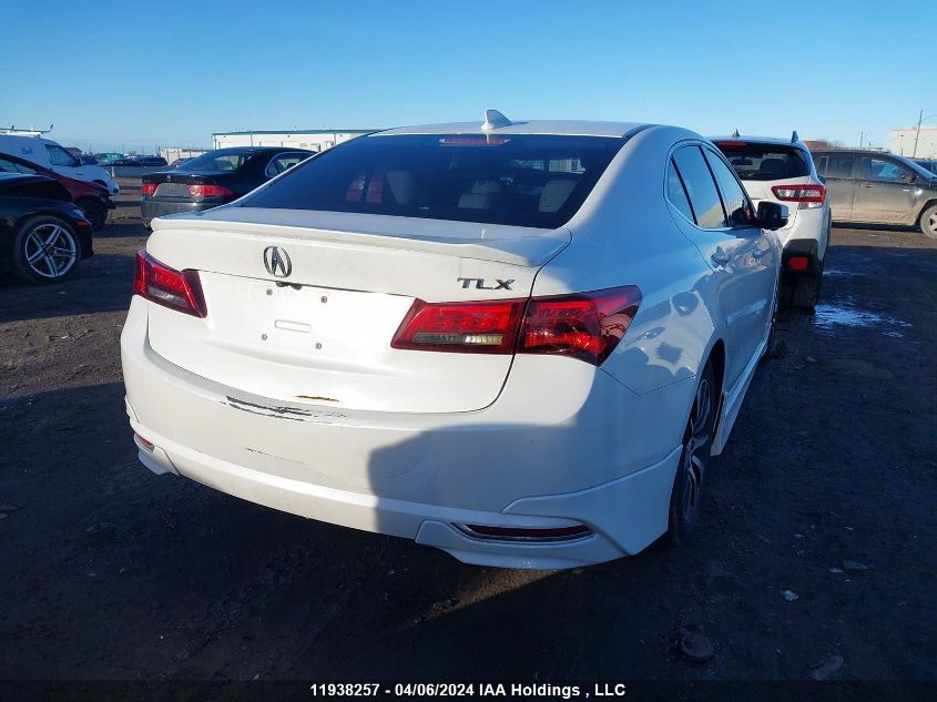 2015 Acura Tlx VIN: 19UUB1F51FA800363 Lot: 11938257