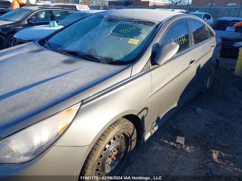 2014 Hyundai Sonata Gls VIN: 5NPEB4ACXEH915111 Lot: 11941772