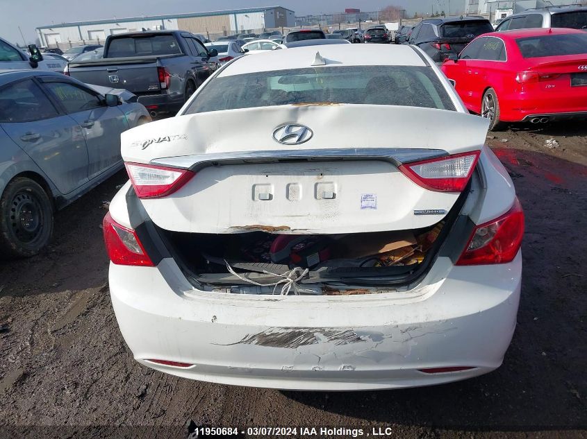 2013 Hyundai Sonata Se/Limited VIN: 5NPEC4AC6DH804728 Lot: 11950684