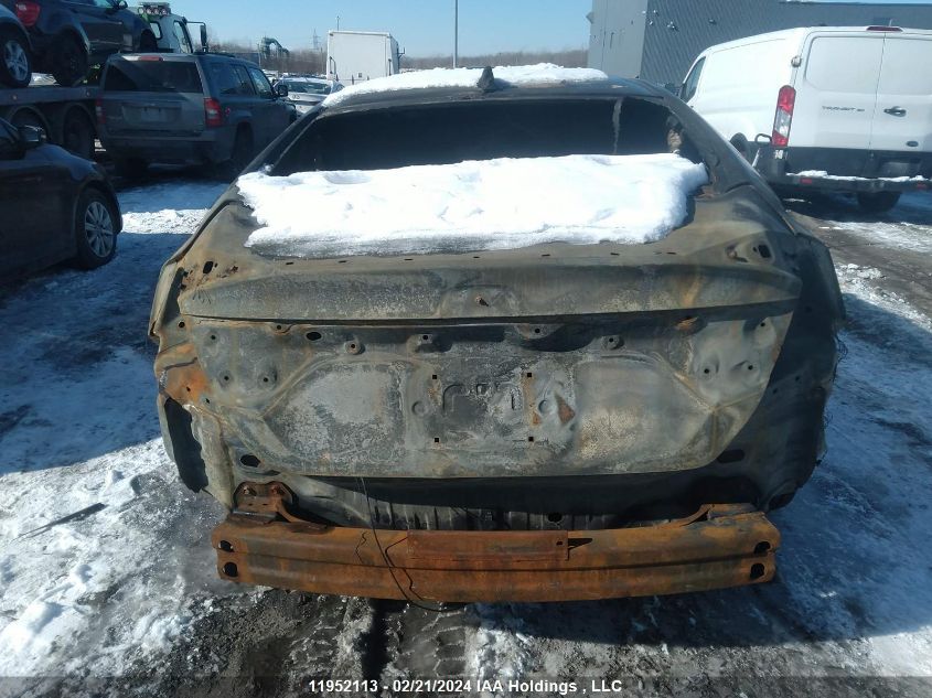 2018 Honda Civic Sedan VIN: 2HGFC1F91JH108204 Lot: 11952113