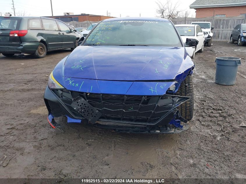 2023 Hyundai Elantra N Manual VIN: KMHLW4AK5PU010931 Lot: 39241417