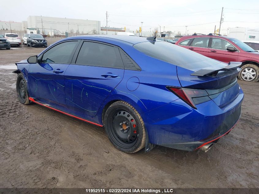 2023 Hyundai Elantra N Manual VIN: KMHLW4AK5PU010931 Lot: 39241417