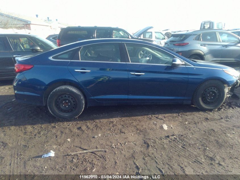 2016 Hyundai Sonata Se VIN: 5NPE24AF3GH423419 Lot: 11962010