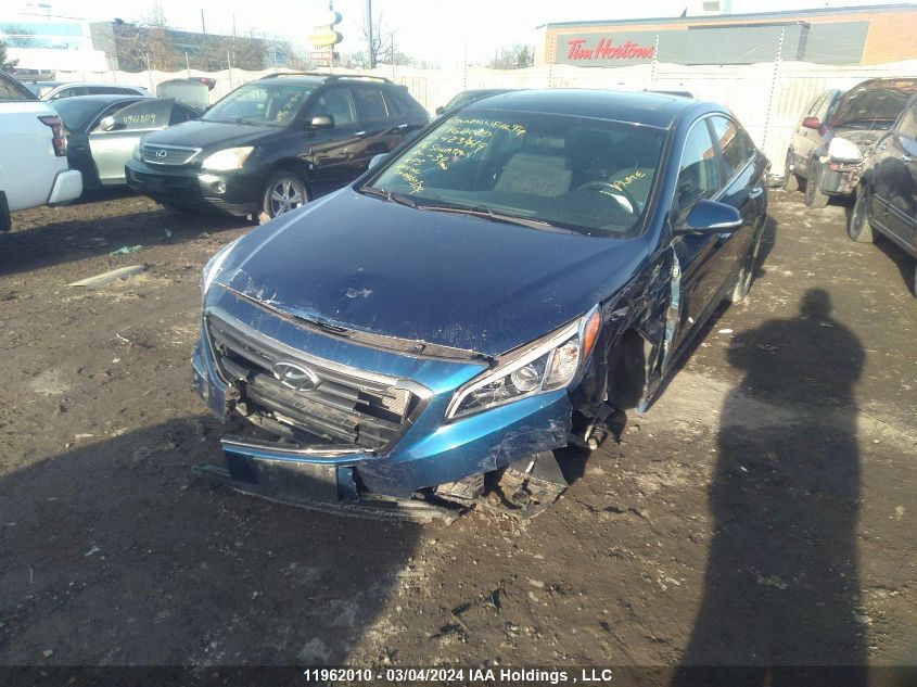 2016 Hyundai Sonata Se VIN: 5NPE24AF3GH423419 Lot: 11962010