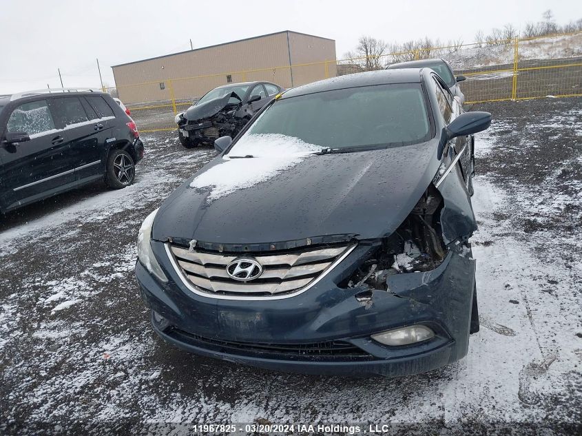 2011 Hyundai Sonata Gls VIN: 5NPEB4AC0BH235326 Lot: 11967825