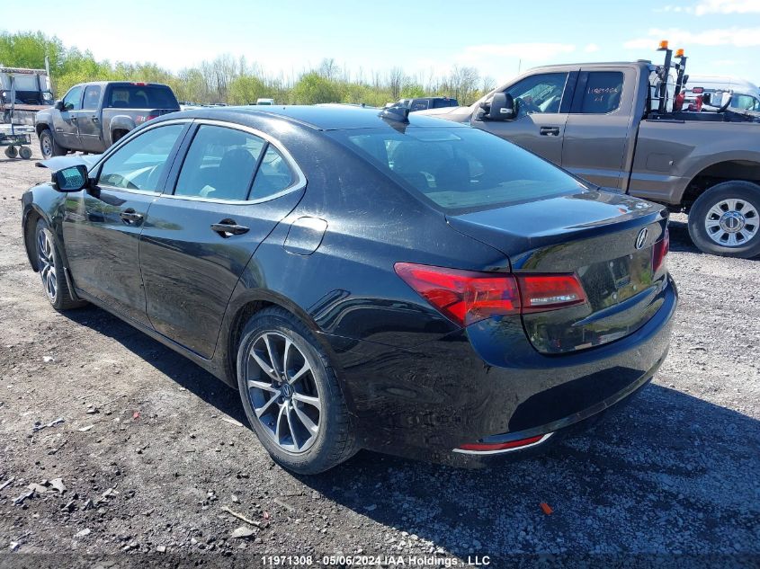 2016 Acura Tlx VIN: 19UUB3F31GA800570 Lot: 11971308